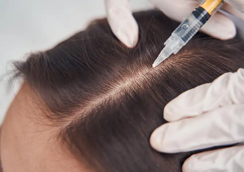 کوکتل درمان ریزش مو فیوژن F-HAIR